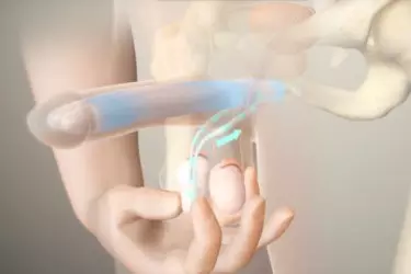 best doctor for penile implant surgery in india, dr deepanshu gupta for penile implant surgery, best doctor for ed treatment in india, best hospital for penile implant surgery in india, cost of penile implant surgery, sethi hospital gurgaon
