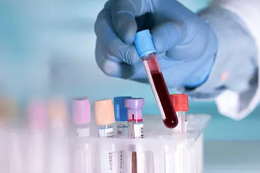best laboratory for blood tests in gurgaon, best nabl lab for blood tests in gurgaon, accurate blood test reports in gurgaon